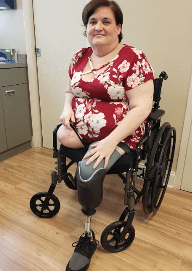 Double amputee shares her story of leaving the wheelchair behind