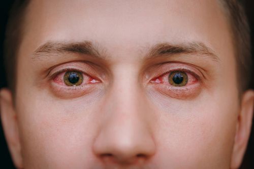 dilated pupils weed