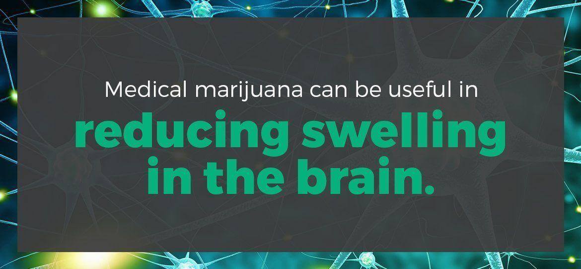 Medical marijuana can be useful in reducing swelling in the brain.